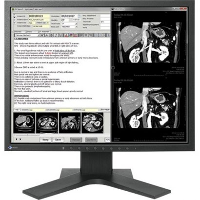 Eizo RadiForce 1MP 48.1 cm (19.0") COLOR LCD Monitor MX194-BK